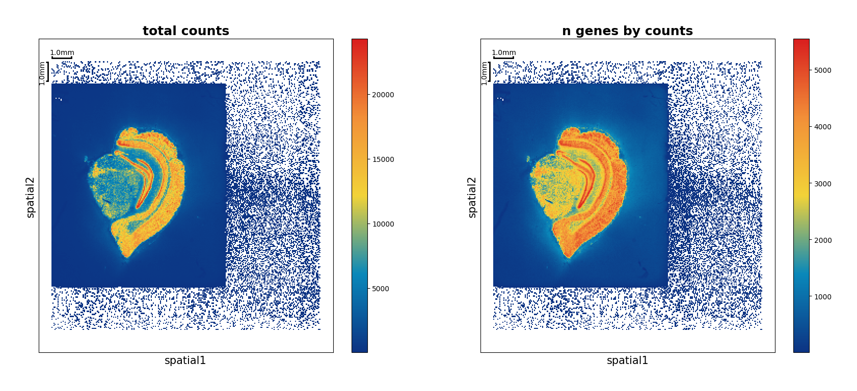 ../_images/Tutorials_Tissue_Segmentation_14_5.png